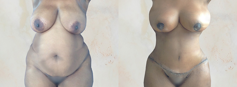 Mommy Makerover Before and After