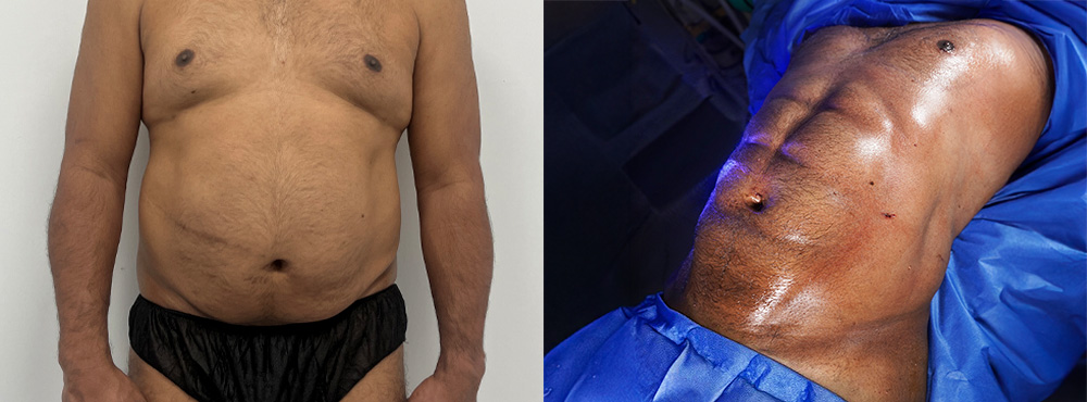 Macho Makeover Before and After