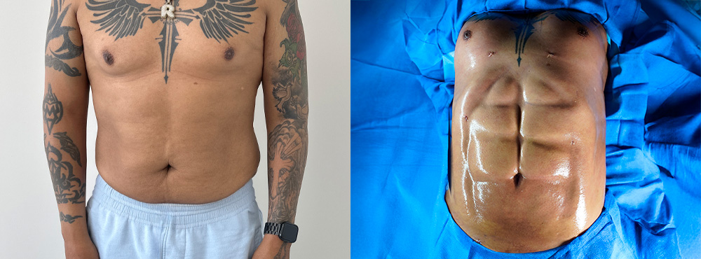 Macho Makeover Before and After
