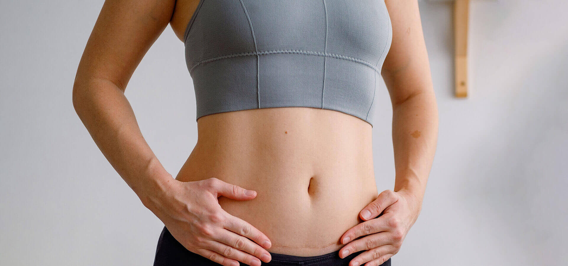 about tummy tuck scars