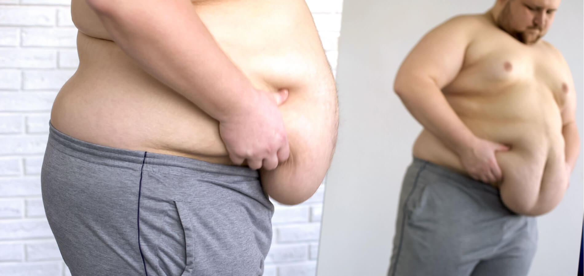 do i qualify for weight loss surgery