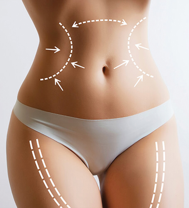 https://cdn.avanaplasticsurgery.com/themes/avana/images/blog/605x665/liposuction-and-j-plasma-for-tightening-abdomen.jpg
