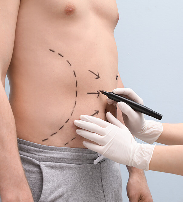 Male Transformations Through Plastic Surgery