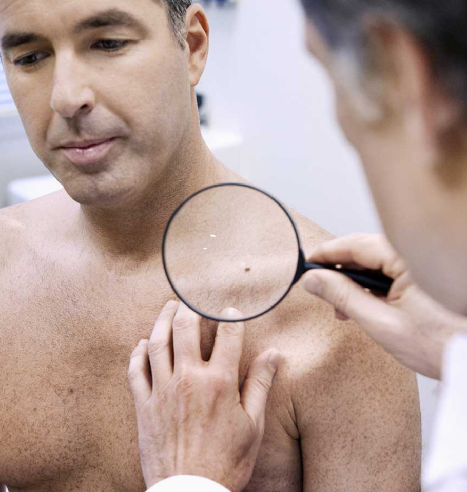 Cirugía de eliminación de cáncer de piel en Miami