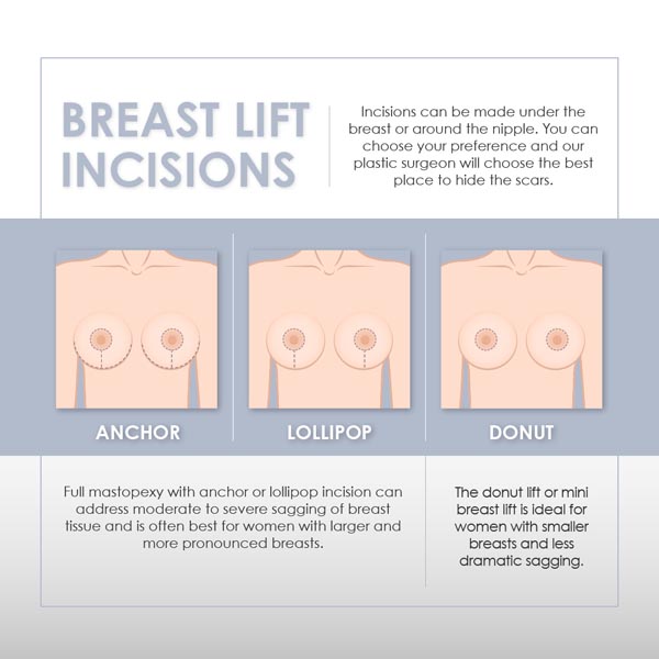 Best Breast Lift Miami, FL
