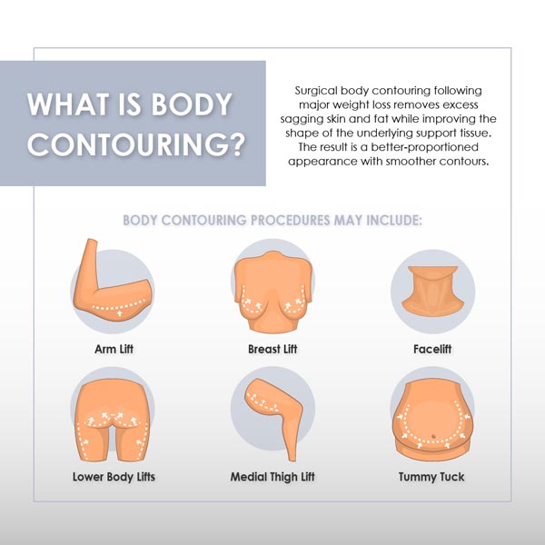 Body Contouring: Types, Surgery and Recovery - REPC