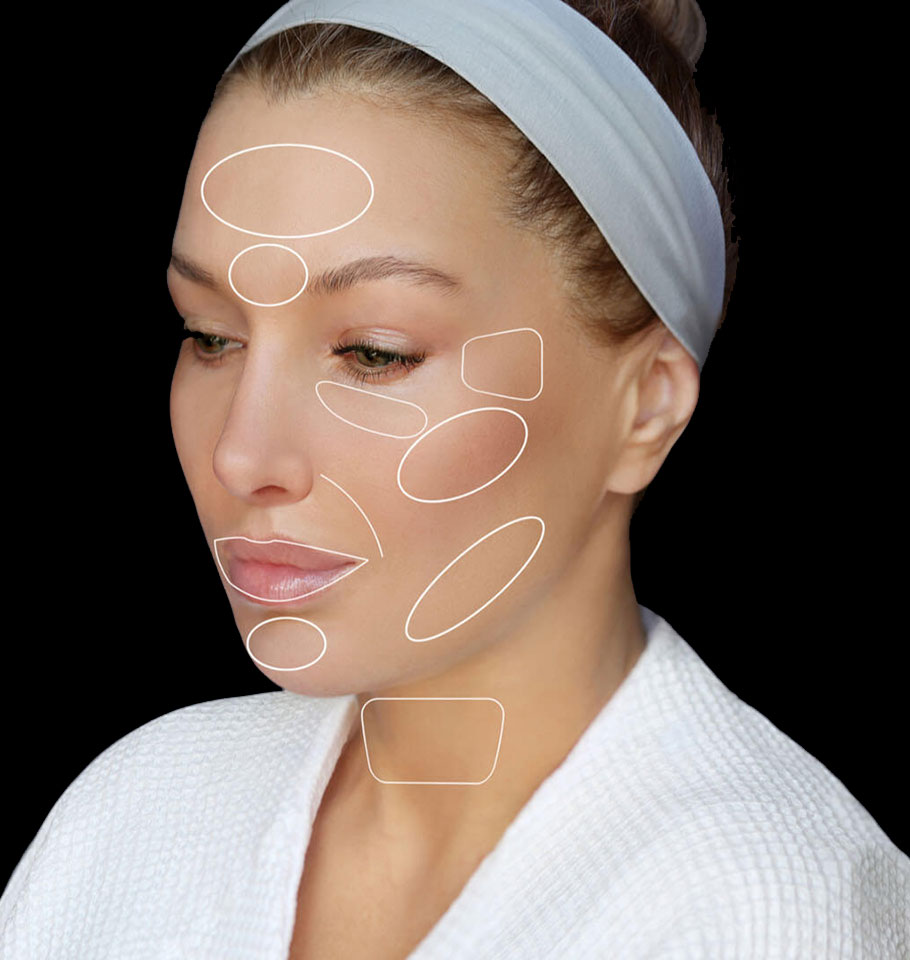 dermal fillers injection areas