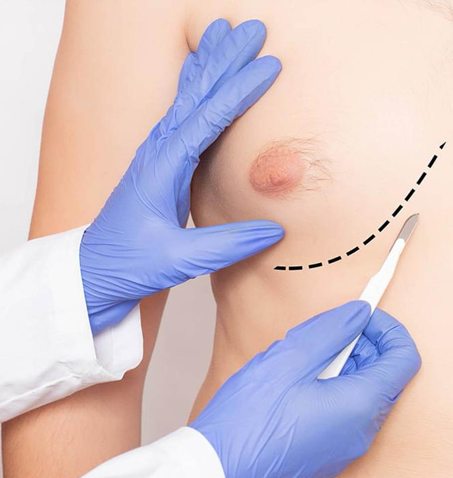 Recuperación de la liposucción